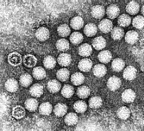 Electron micrograph of enterovirus particles. Photo by Linda M. Stannard, University of Cape Town as reproduced in Wong's Virology online.
