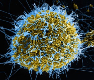 In an electron microscope image that has been colorized, Ebola virus particles in blue are being extruded from an African Green Monkey kidney cell in yellow. Photo produced by  National Institute of Allergy and Infectious Diseases, NIH.